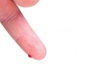 ���������Щ֢״˵������Ҫ��Ѫ���ˣ�