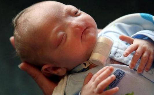 û�б��ӵ�Ӥ��������˵����������